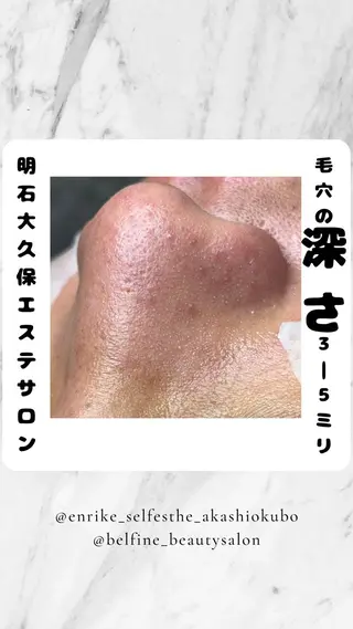 セルフエステエンリケ明石大久保店所属・夕希リンパ&痩身& 脱毛&毛穴ケアのエステ・リラクイメージ