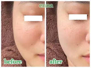 三上 笑里奈のエステ・リラクイメージ