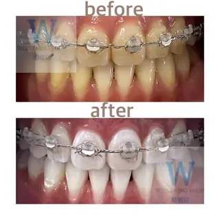 ホワイトニング ショップ本八幡店のエステ・リラクイメージ