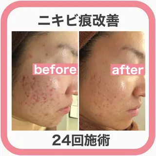 ミディアム カラー パーマ ヘアアレンジ メンズ キッズ ネイル マツエク・マツパ ニキビ・肌質改善専門 ♡人生が変わるサロンのエステ・リラクイメージ