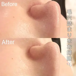 アイラッシュ&エステサロンLinda西宮所属・小顔&毛穴・肌質改善 LINDA西宮 AIのエステ・リラクイメージ