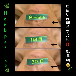 ヴィーナス ビューティーのエステ・リラクイメージ