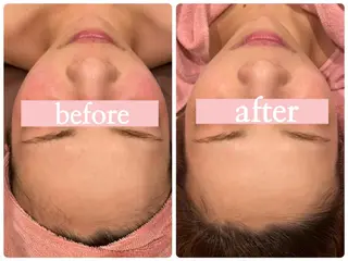 ♡RAYVIS♡ 名古屋店　神田のエステ・リラクイメージ