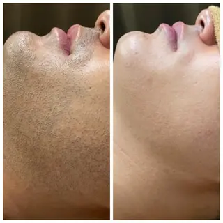 メンズ ヘアーサロンいしざわ所属・いしざわ /メンズ脱毛サロンのエステ・リラクイメージ