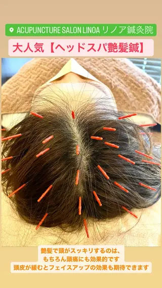 Acupuncture  salon LINOA リノア鍼灸院所属・LINOAヘッドスパ 小顔ケア/逆子ケアのエステ・リラクイメージ