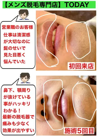 メンズ 【メンズ脱毛専門店】TODAY所属・都度払い制メンズ脱毛 オーナーのエステ・リラクイメージ