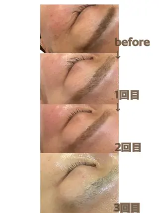 aroma  YURARI所属・韓国艶美人// 毛穴ケア🌹のエステ・リラクイメージ