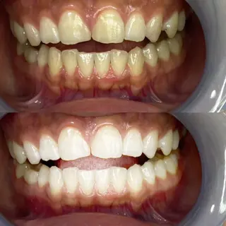 マツエク・マツパ ストーリー所属・セルフホワイトニング 耳ツボジュエリーのエステ・リラクイメージ