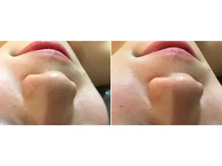 バストケア RAYVIS梅田店Nのエステ・リラクイメージ