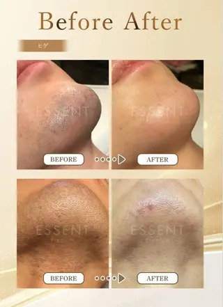 メンズ 高端 百合香のエステ・リラクイメージ