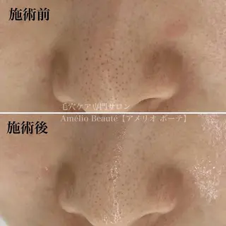 毛穴ケア専門サロン Amélio Beauté所属・毛穴ケア専門サロン アメリオボーテのその他イメージ
