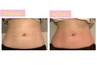 癒し腸もみサロン シャユーム　ゆきなのエステ・リラクイメージ