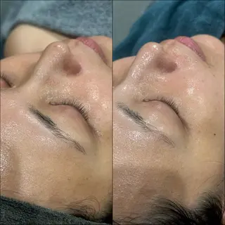 LiZA エステティックサロンのエステ・リラクイメージ