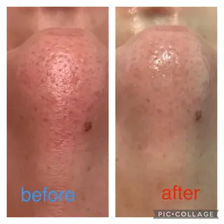 エステティックサロンアトリエホミィ所属・エステティックサロン アトリエ　ホミィのエステ・リラクイメージ