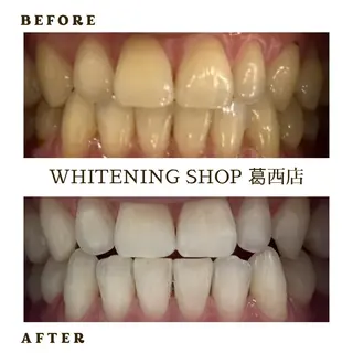 メンズ ホワイトニング ショップ葛西店のその他イメージ