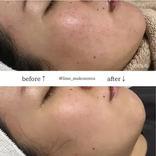 LIME武庫之荘所属・LIME 武庫之荘店のエステ・リラクイメージ