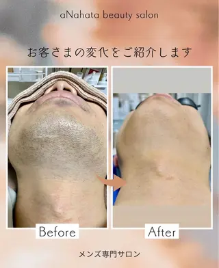 メンズ aNahata beauty salon所属・田中 菜月のエステ・リラクイメージ