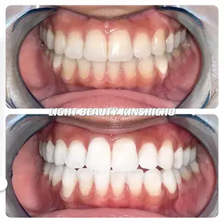 メンズ ライトビューティー 錦糸町店のエステ・リラクイメージ