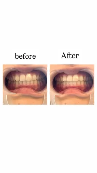 浮腫|肩こり|張り 日々の疲れを解消⭐️のエステ・リラクイメージ