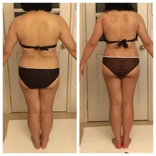 吸い玉痩身専家所属・吸い玉 痩身専家FDLのエステ・リラクイメージ