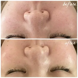 メンズ メナード岐阜茜部 杉浦のエステ・リラクイメージ