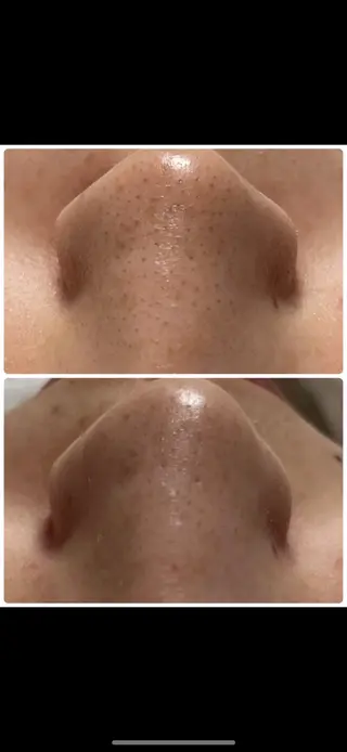 anela 🧖‍♀️のエステ・リラクイメージ