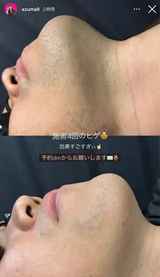 total beauty salon Li-Amica所属・KARIN/りあみか /眉毛/まつげ/脱毛のマツエク・マツパデザイン