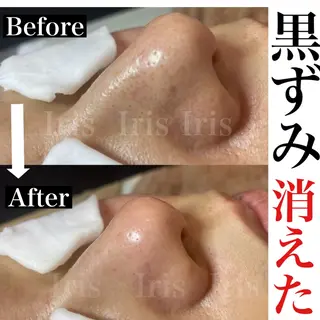 Aki 似合わせまつ毛💎のエステ・リラクイメージ