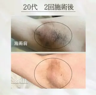 💠the4💠【脱毛特化サロン】所属・LED脱毛サロン 💐ayaのエステ・リラクイメージ