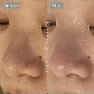 Rumia Salonのエステ・リラクイメージ