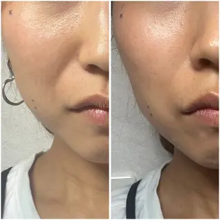 MORE BEAUTY ESTHE 本通り店所属・more ‎‪𓍯 ‬のエステ・リラクイメージ