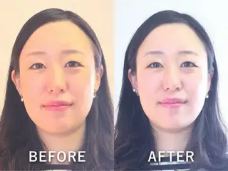 坂井 ゆいのエステ・リラクイメージ