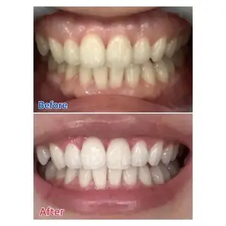 M渋谷店所属・M渋谷 ホワイトニングのエステ・リラクイメージ