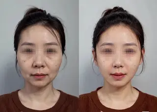 aliaハイフ&水光ジェットサロン所属・aliaハーブ水光店 エステティシャン募集のエステ・リラクイメージ