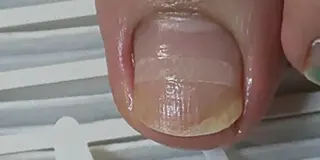 ネイル 爪屋 Orchidのネイルデザイン