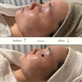 lumirise所属・lumi riseのエステ・リラクイメージ