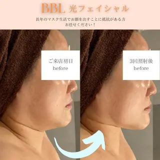 DahliaBeauty ダリアビューティー所属・Dahlia痩身脱毛 フェイシャル 中村のエステ・リラクイメージ