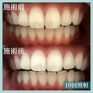 LBS 吉祥寺店🐣店長加納のエステ・リラクイメージ