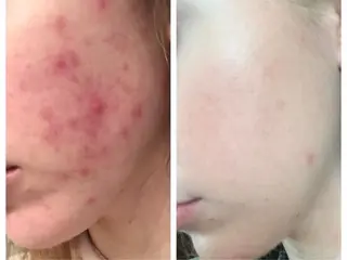 ピーリング・脱毛・ブラジリアンワックス専門店【Fofo仙台泉区店】所属・ピーリング・脱毛専門 Fofo泉区店のその他イメージ