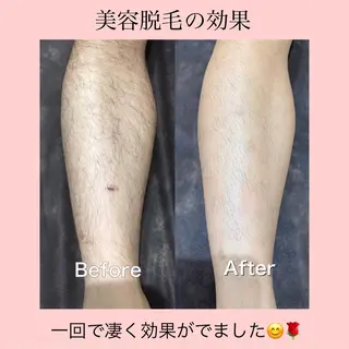 セミロング カラー パーマ ヘアアレンジ キッズ ネイル マツエク・マツパ Chloe-クロエ- 脱毛/フェイシャルのエステ・リラクイメージ