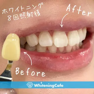 ホワイトニング カフェ川越店のエステ・リラクイメージ