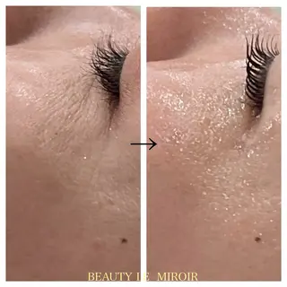 ビューティー ミロワールのエステ・リラクイメージ