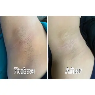 都度払い制脱毛サロンBe Charm所属・Be Charm 山﨑のエステ・リラクイメージ