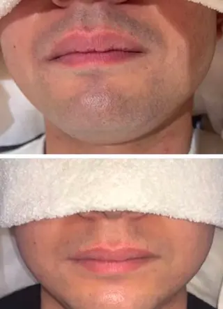 BeautySalon REPOS所属・HINA 🌹のエステ・リラクイメージ