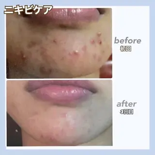 🖤RAYVIS🖤 青森店　山内のエステ・リラクイメージ