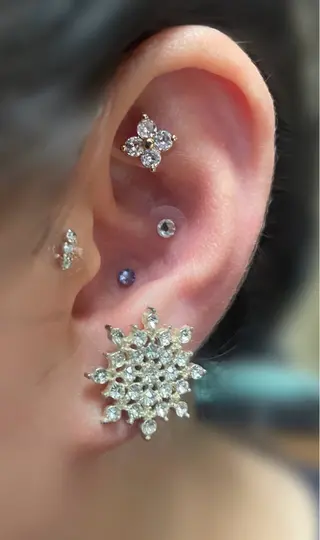 肌質改善｜エステ Connect ゆいのエステ・リラクイメージ