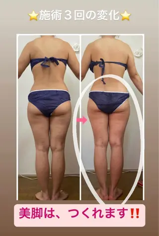 ショート カラー パーマ ヘアアレンジ メンズ キッズ ネイル マツエク・マツパ ‍痩身＆ボディ 結果出し🌟丹野のエステ・リラクイメージ