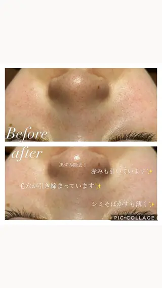 natura chuchuナトゥーラチュチュ所属・バスト体験 ナトゥーラチュチュのエステ・リラクイメージ