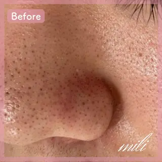 【毛穴ケア専門店✨】 mili 須藤歩華のエステ・リラクイメージ