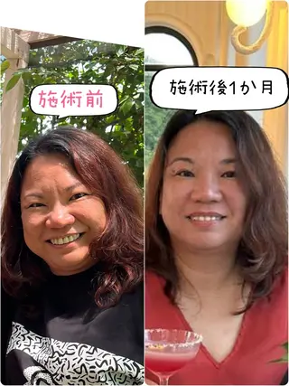 Anne’s happyBonesのエステ・リラクイメージ